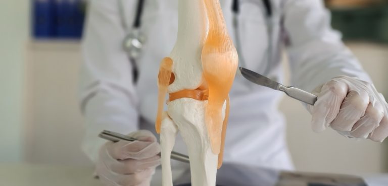 Arthroscopie